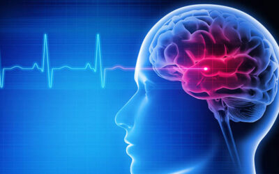 Recognizing the Warning Signs and Symptoms of a Stroke