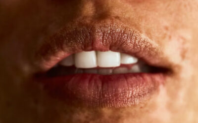 Dehydration Symptoms: Are You Drinking Enough Water in Winters?